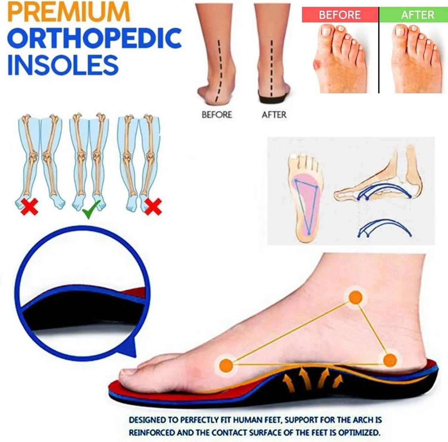 Mules for Women Summer Non Slip Orthopedic Shoes with Arch Support Comfortable Breathable Mesh Walking Clogs Dressy Closed Toe Slip On Slippers Casual Open Back Shoes